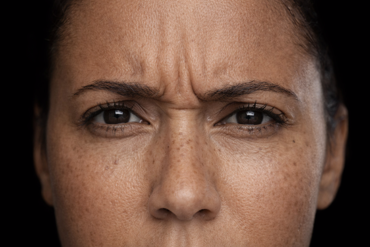 Before neurotoxin treatment