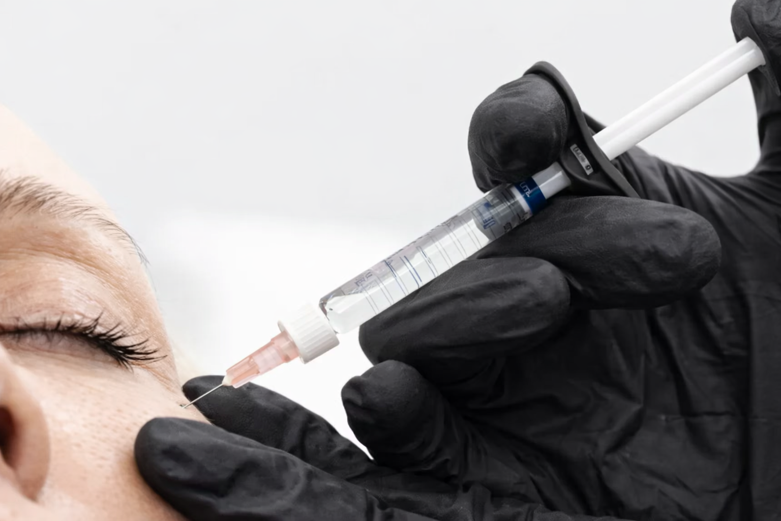 Facial Balancing treatment at ReSculpt Aesthetics